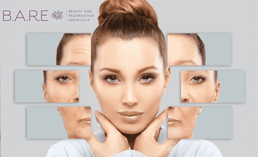 Botox Fillers Windsor Ontario