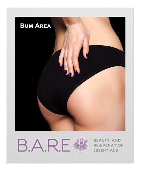 Hair Removal for buttocks