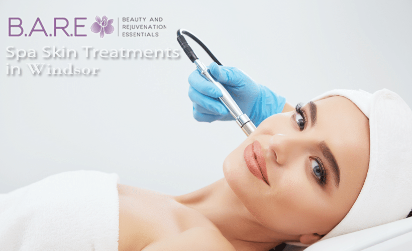 microdermabrasion treatment in Windsor