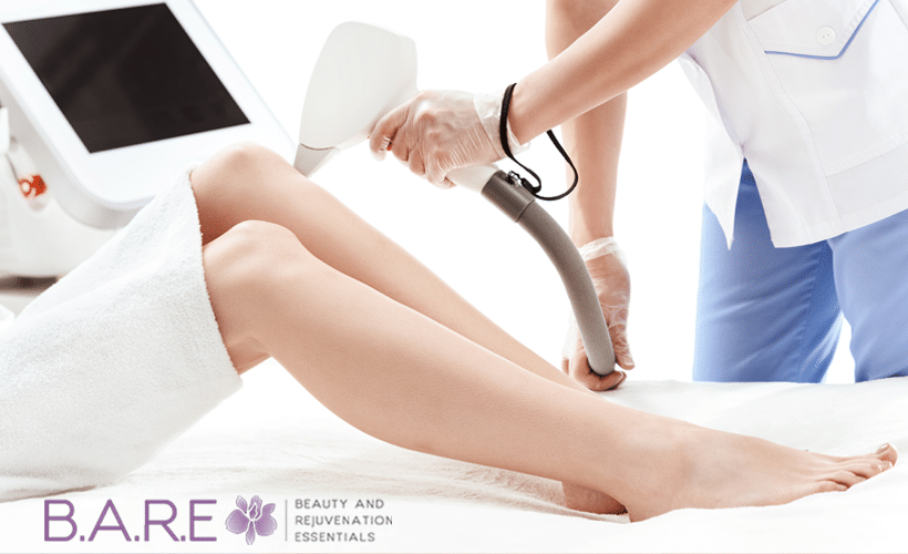 How long does laser hair removal last? .E. Essentials Spa