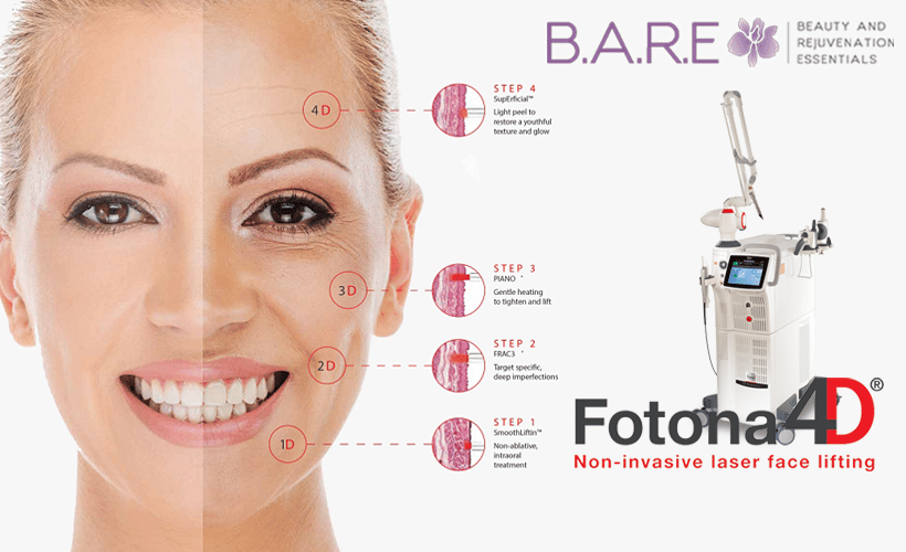 Fotona 4D Laser Facial Treatment