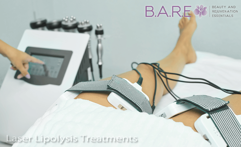 Laser Lipolysis Treatments