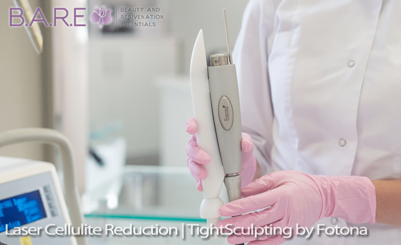 Laser Cellulite Reduction TightSculpting