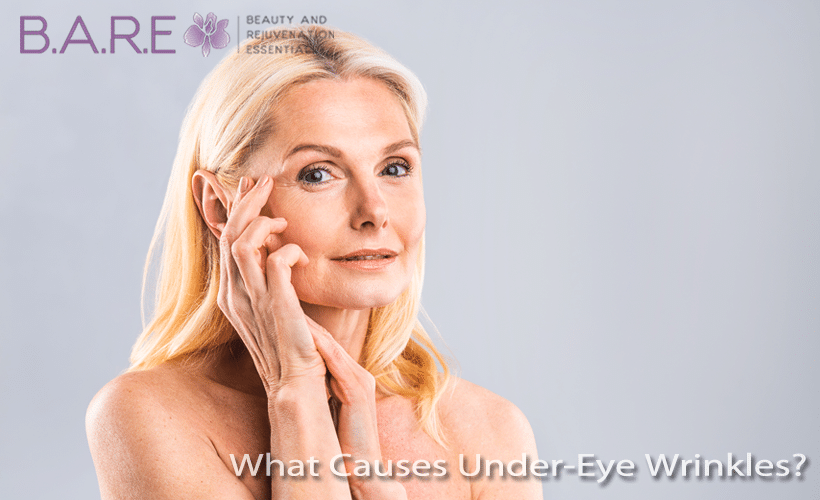 What Causes Under Eye Wrinkles on your Face?