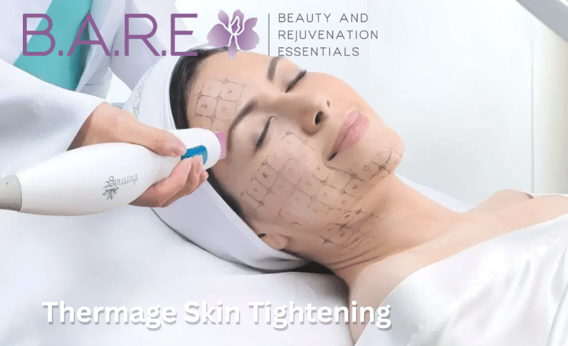 Thermage Skin Tightening Treatments Windsor