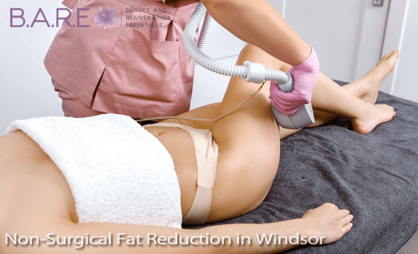 Non-Surgical Fat Reduction Windsor