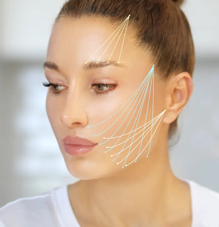 Thermage Skin Tightening in Tecumseh Thermage skin tightening treatment areas on the brow, cheek and jawline at B.A.R.E. Essentials Spa in Tecumseh